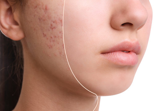 Spot Removal2.jpg
